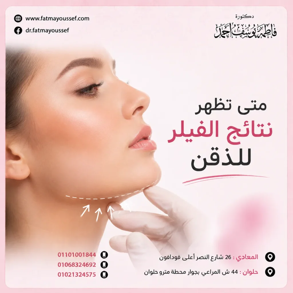 متى تظهر نتائج الفيلر للذقن