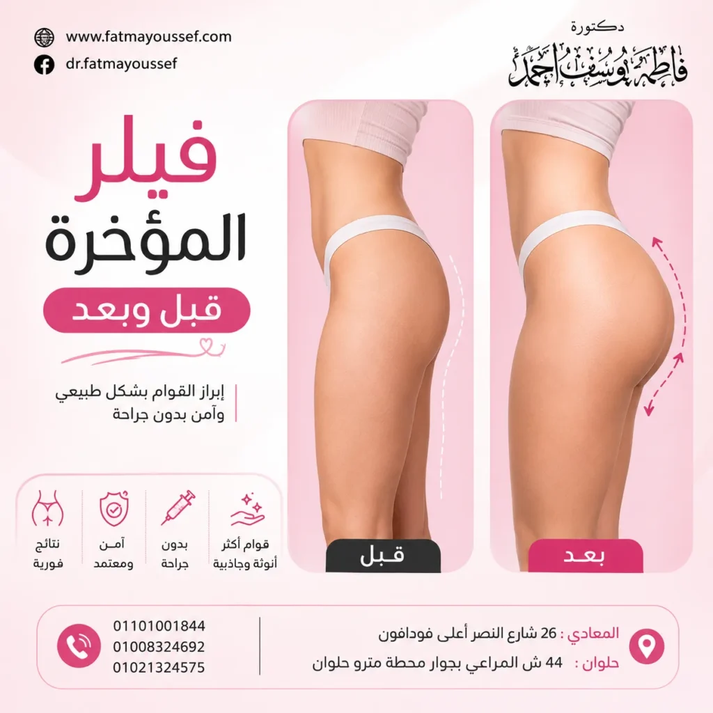 فيلر المؤخرة قبل وبعد