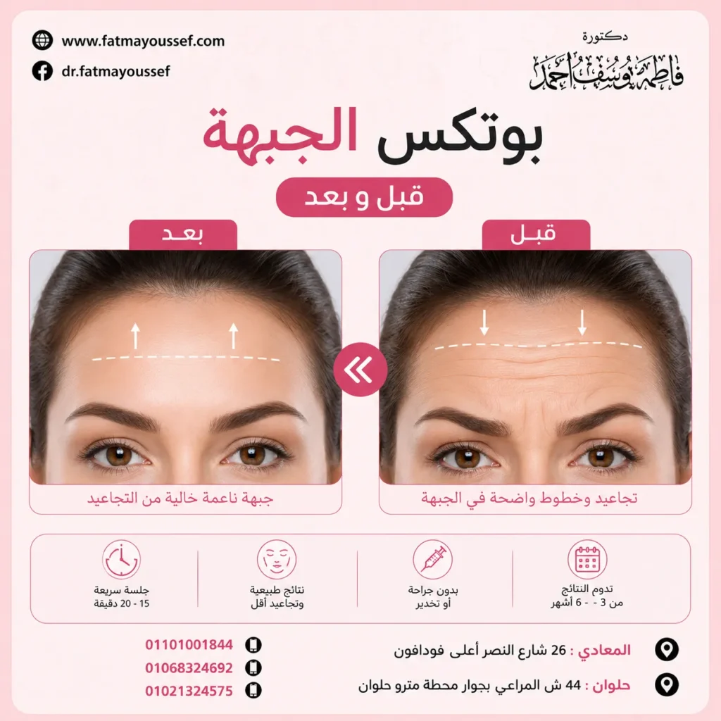 بوتكس الجبهة قبل وبعد
