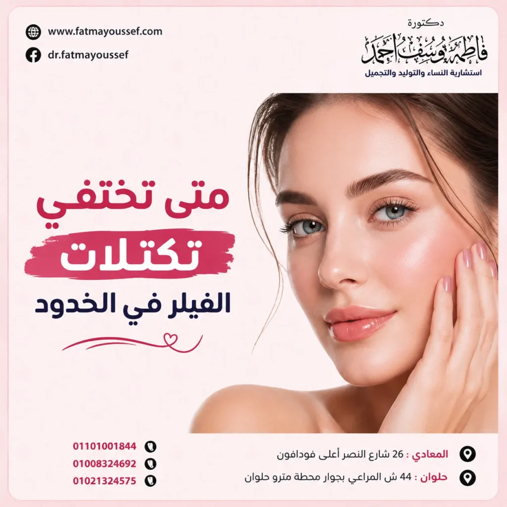 متى تختفي تكتلات الفيلر في الخدود