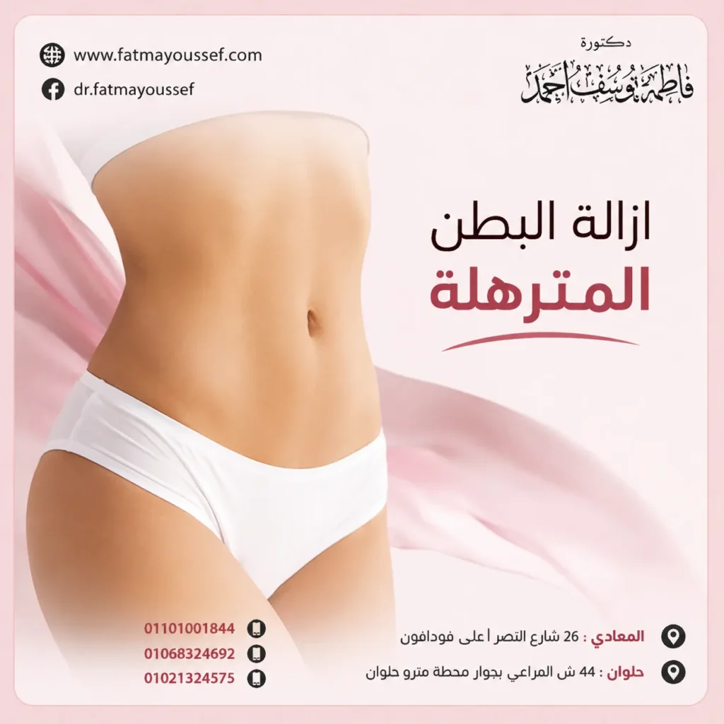 ازالة البطن المترهلة