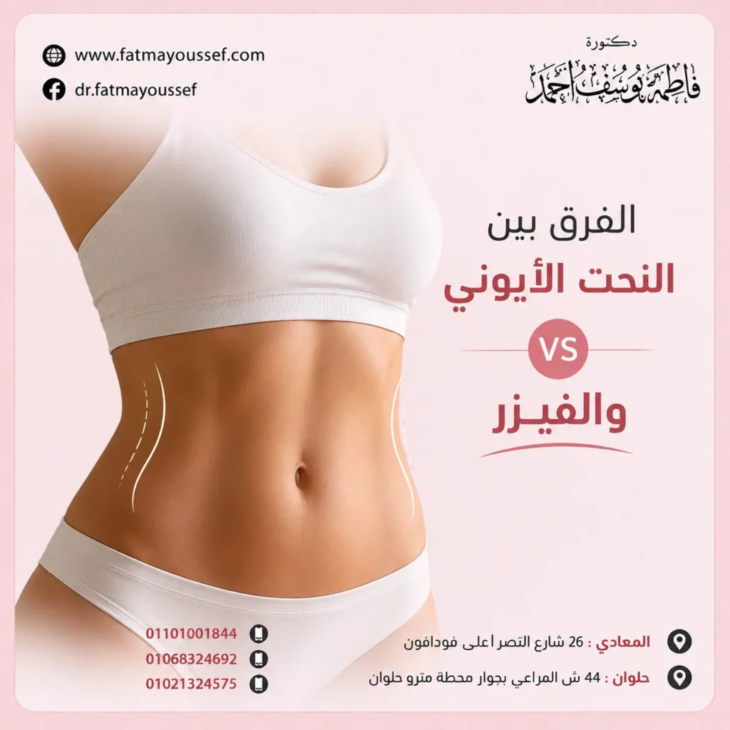 الفرق بين النحت الأيوني والفيزر