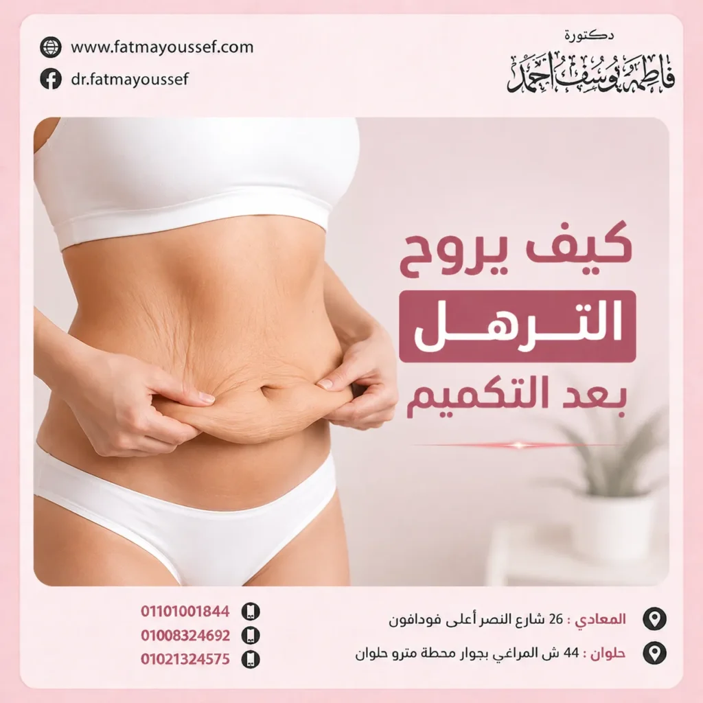 كيف يروح الترهل بعد التكميم