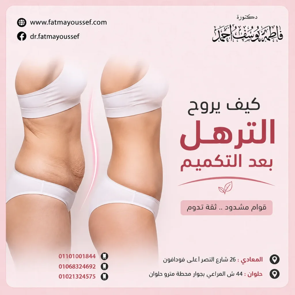 كيف يروح الترهل بعد التكميم