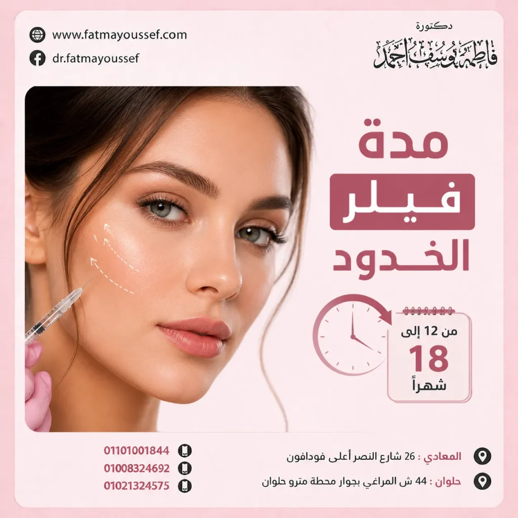 مدة فيلر الخدود