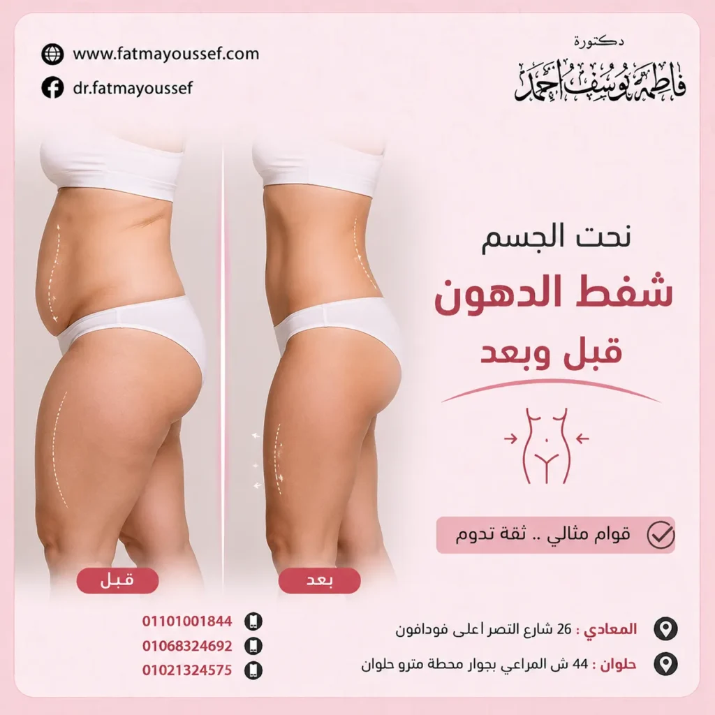 نحت الجسم شفط الدهون قبل وبعد