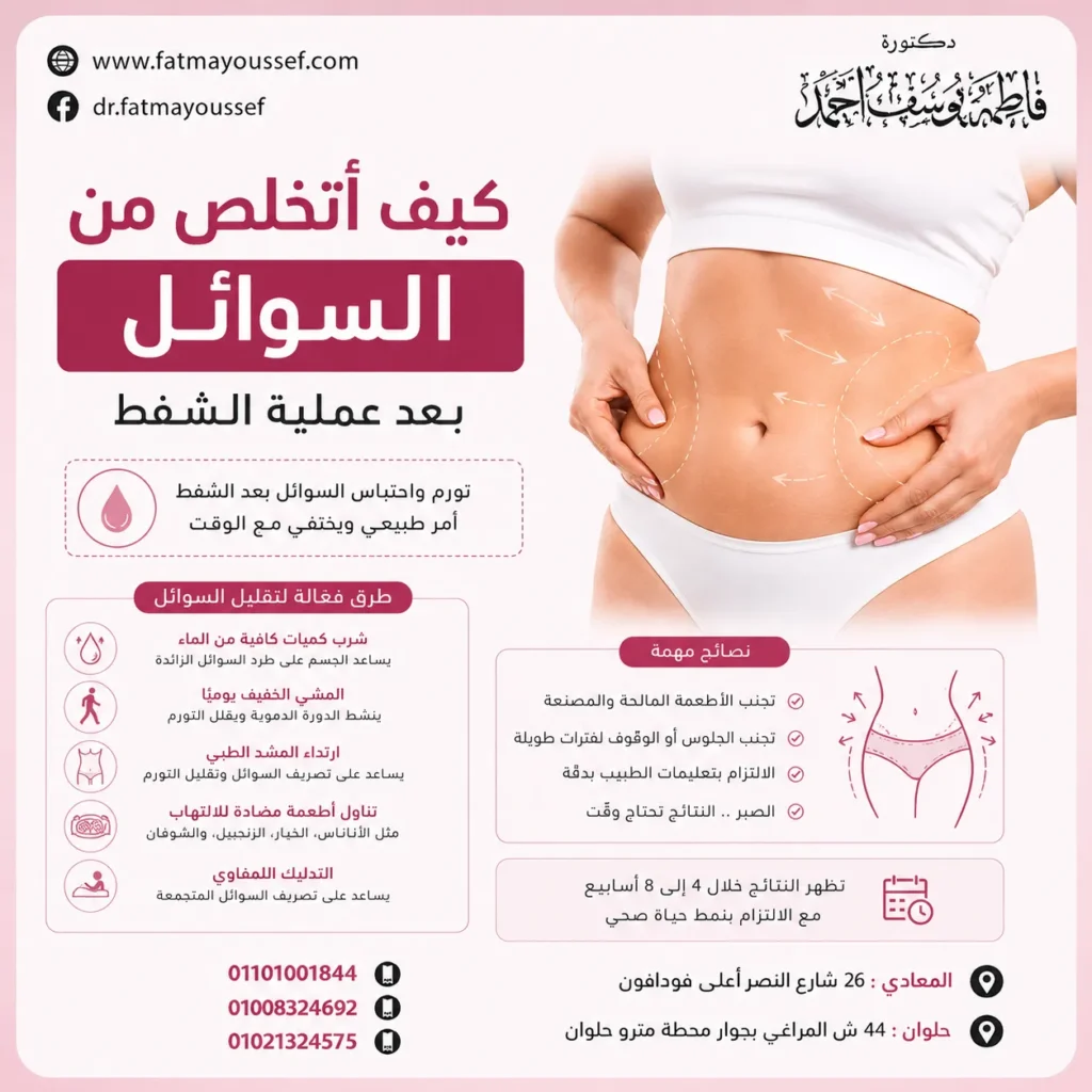 كيف أتخلص من السوائل بعد عملية الشفط