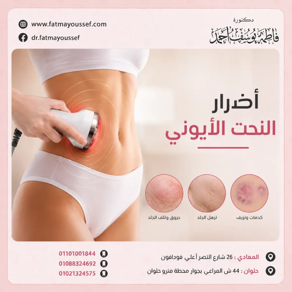 أضرار النحت الأيوني