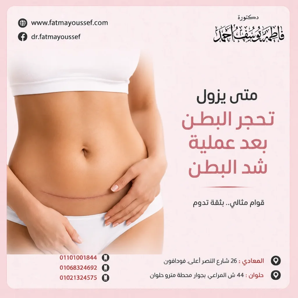 متى يزول تحجر البطن بعد عملية شد البطن