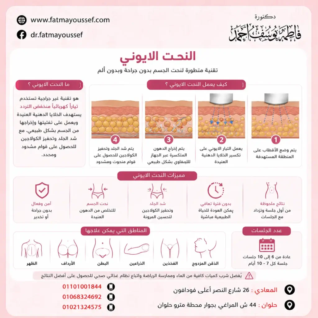 ماهو النحت الايوني