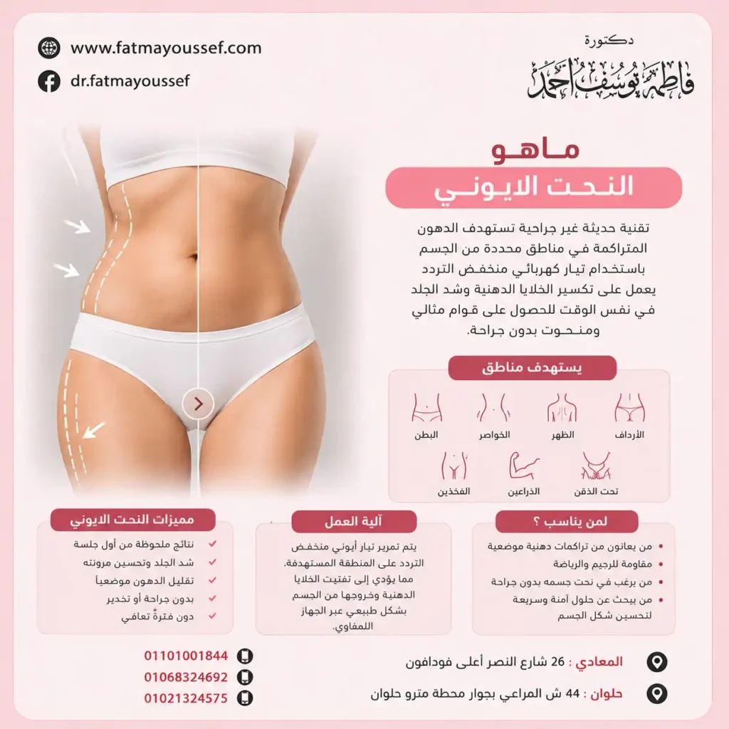 ماهو النحت الايوني