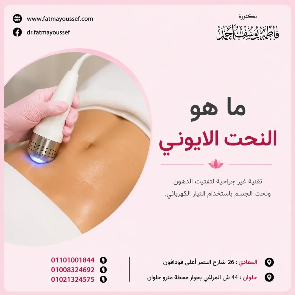 ماهو النحت الايوني