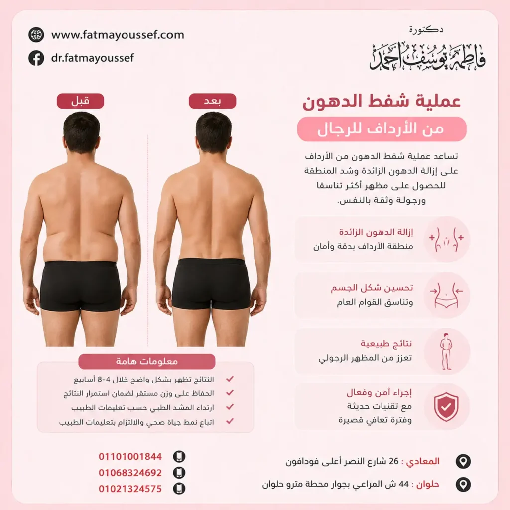 عملية شفط الدهون من الارداف للرجال