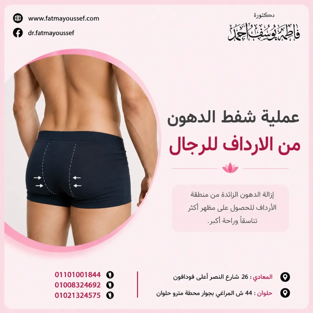 عملية شفط الدهون من الارداف للرجال