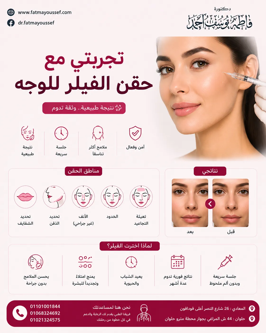 تجربتي مع حقن الفيلر للوجه