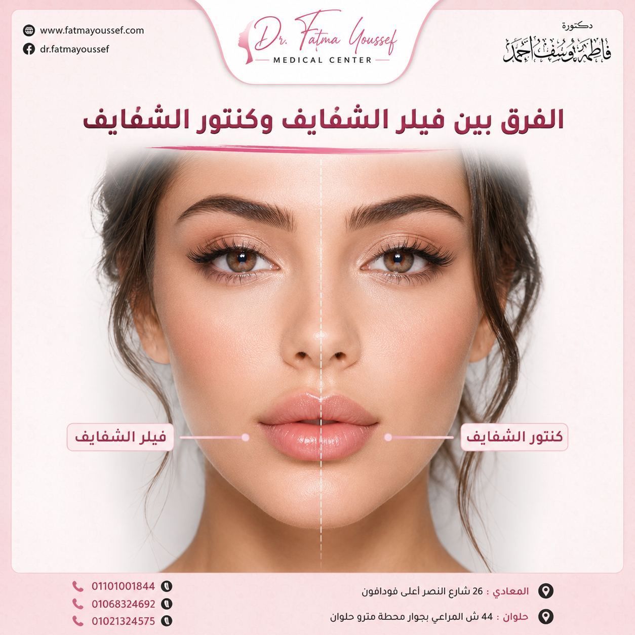 الفرق بين فيلر الشفايف وكنتور الشفايف