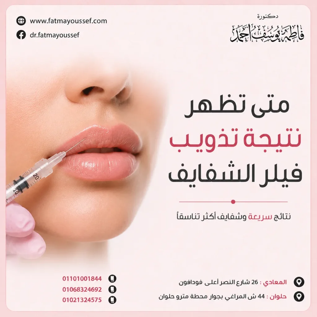 متى تظهر نتيجة تذويب فيلر الشفايف