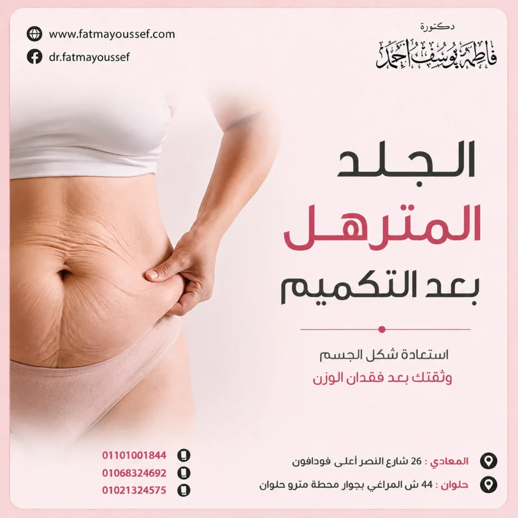 الجلد المترهل الترهل بعد التكميم