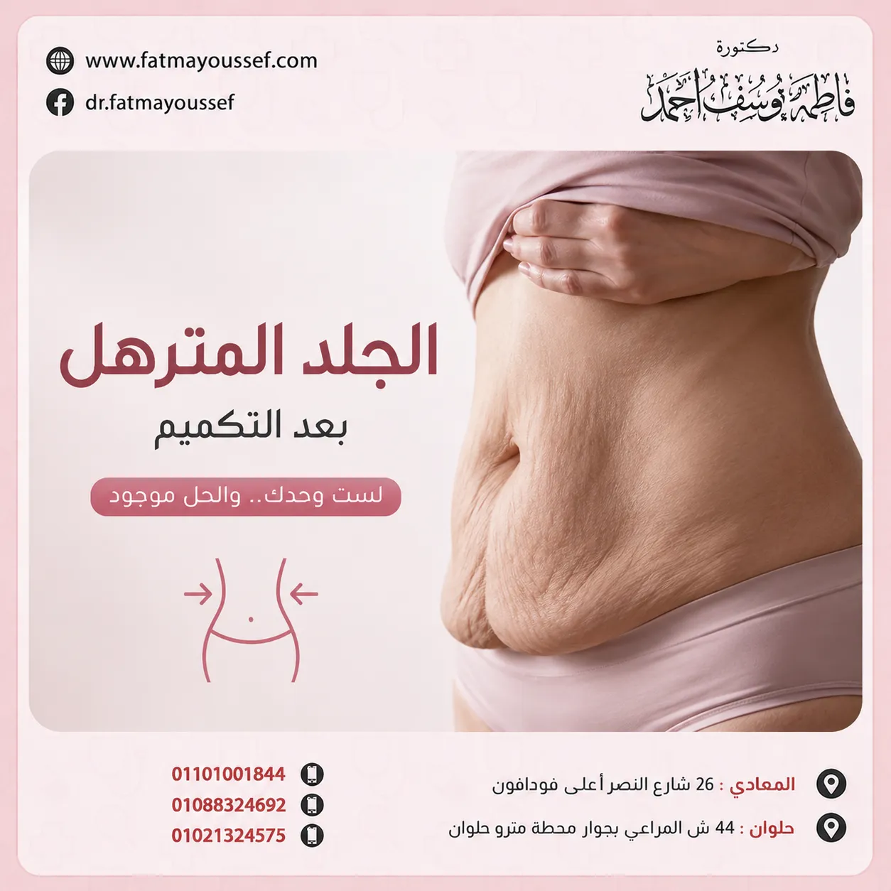 الجلد المترهل الترهل بعد التكميم