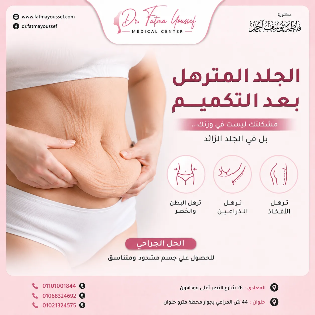 الجلد المترهل الترهل بعد التكميم