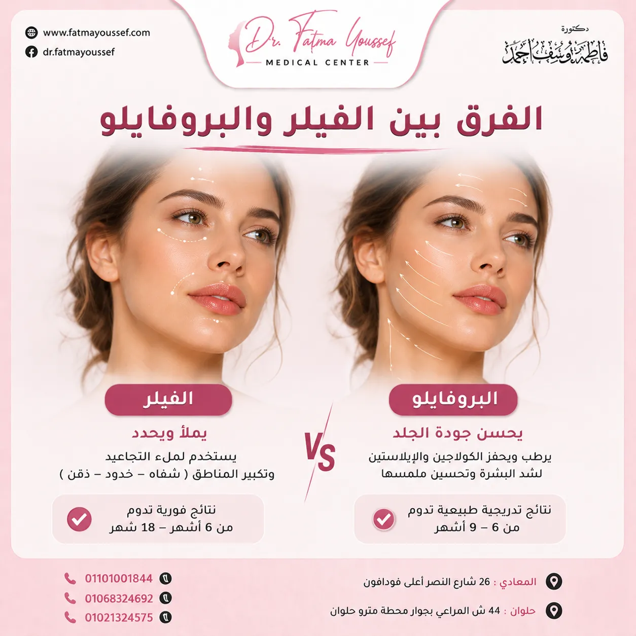 الفرق بين الفيلر والبروفايلو