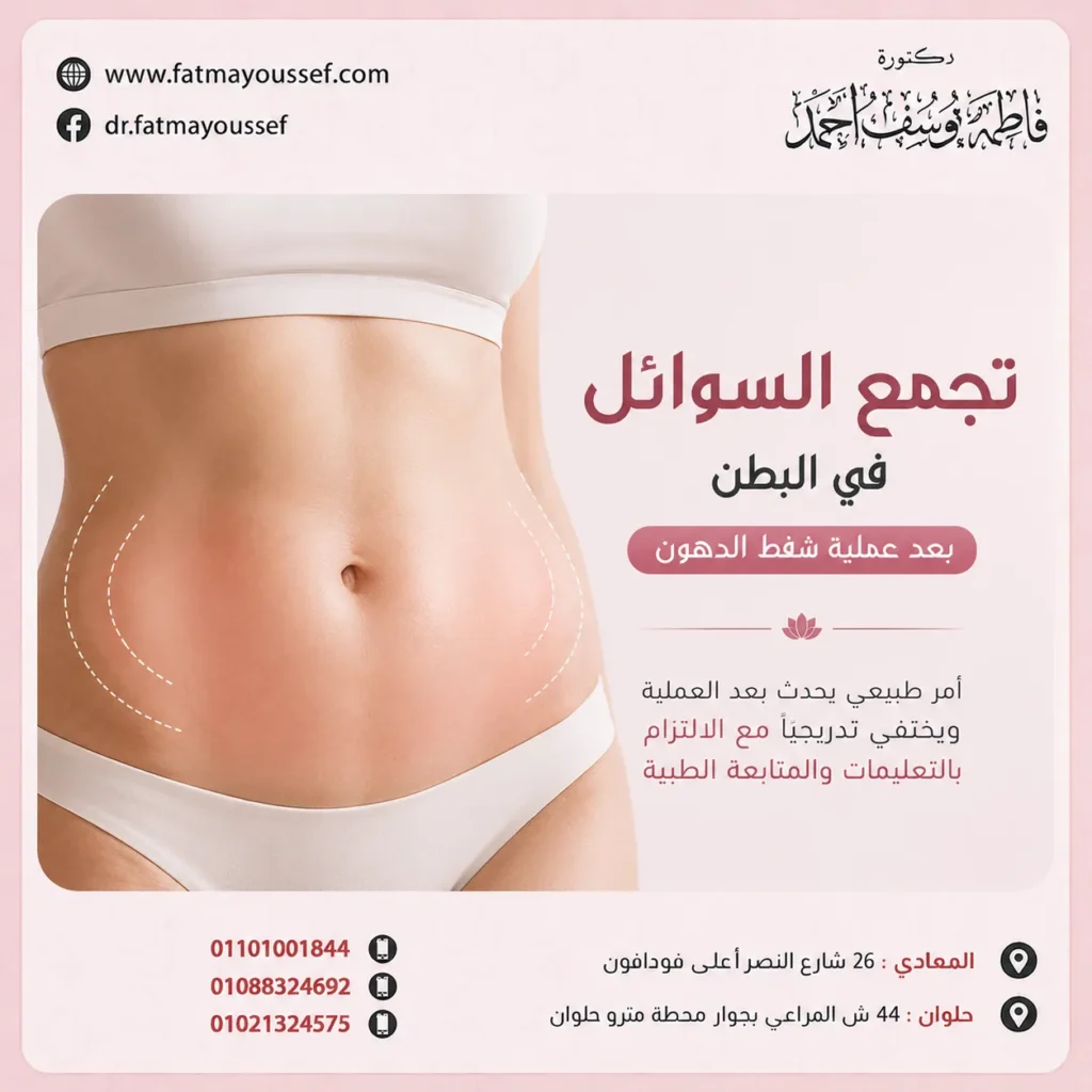 السوائل في البطن بعد عملية شفط الدهون