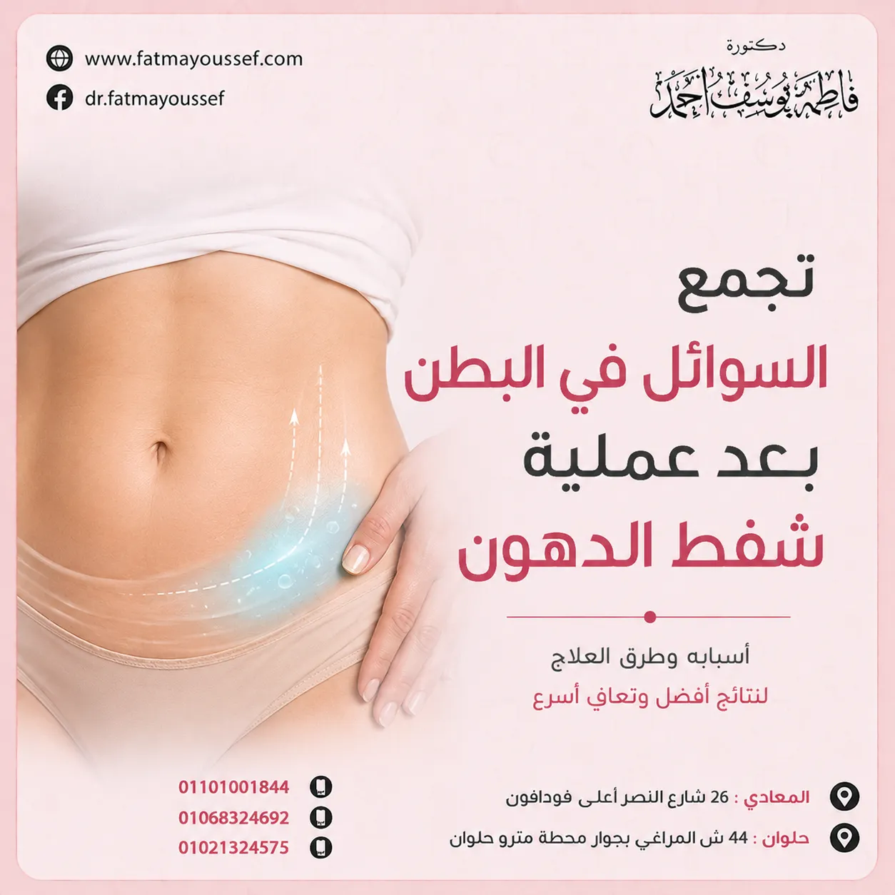 السوائل في البطن بعد عملية شفط الدهون