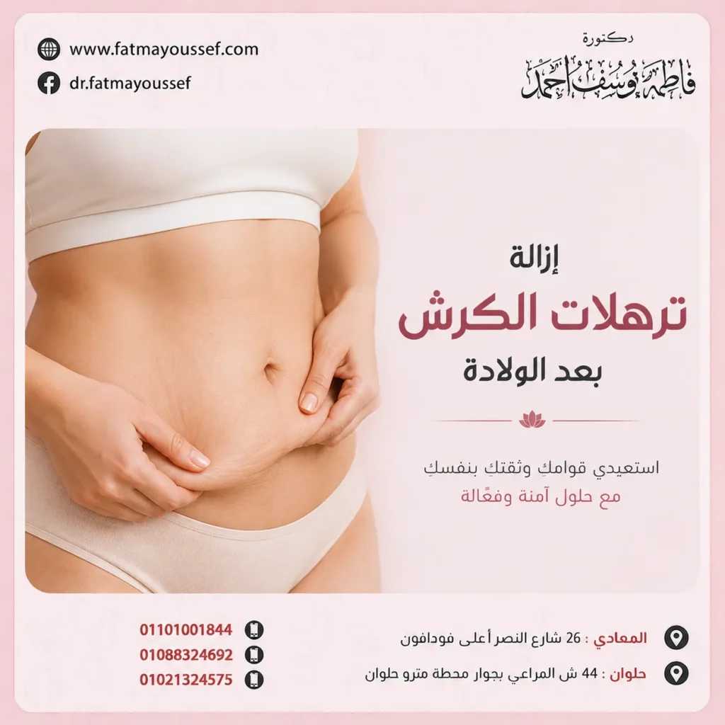ازاله ترهلات الكرش بعد الولاده