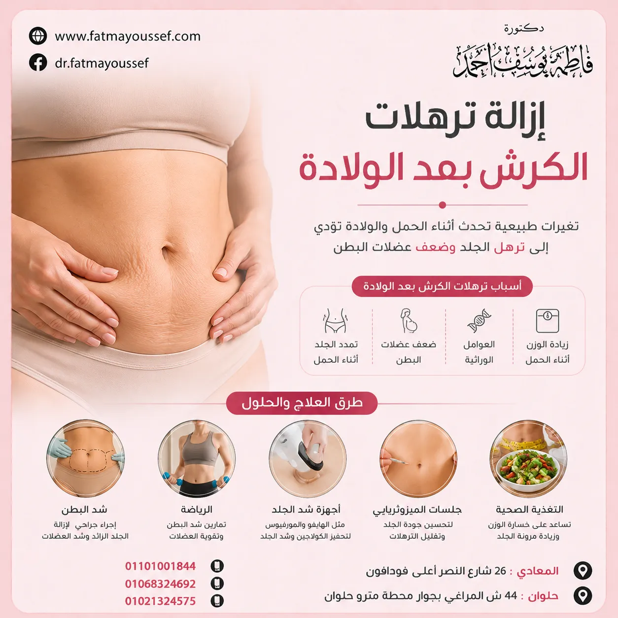 ازاله ترهلات الكرش بعد الولاده