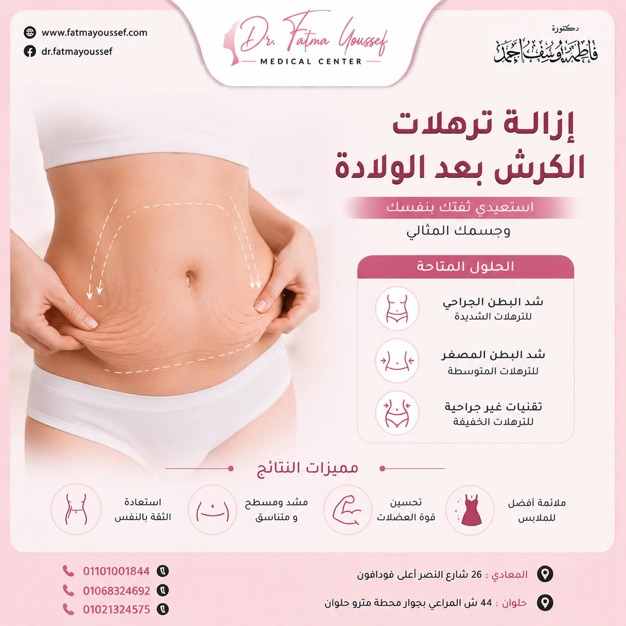 ازاله ترهلات الكرش بعد الولاده