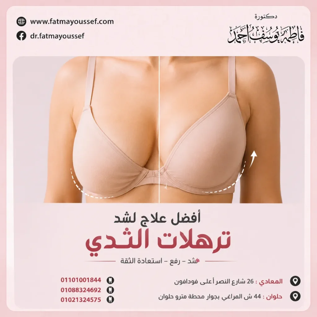 افضل علاج لشد ترهلات الثدي
