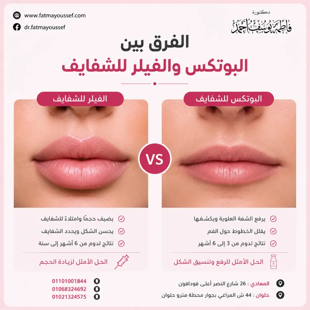 الفرق بين البوتكس والفيلر للشفايف