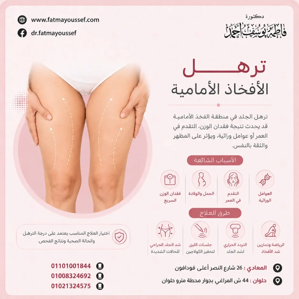ترهل الافخاذ الامامية