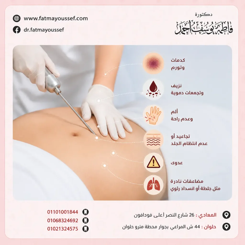 ماهي اضرار شفط الدهون