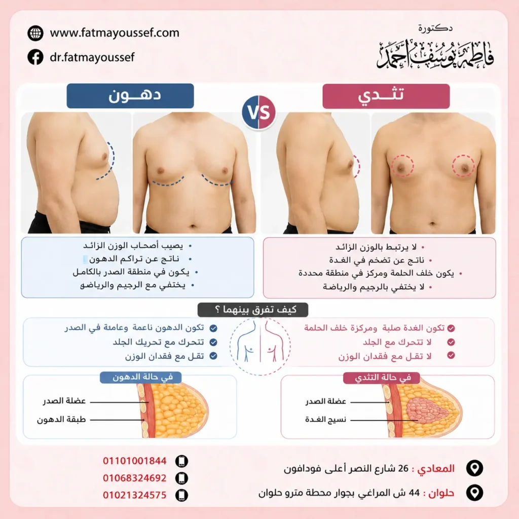 الفرق بين التثدي والدهون بالصور