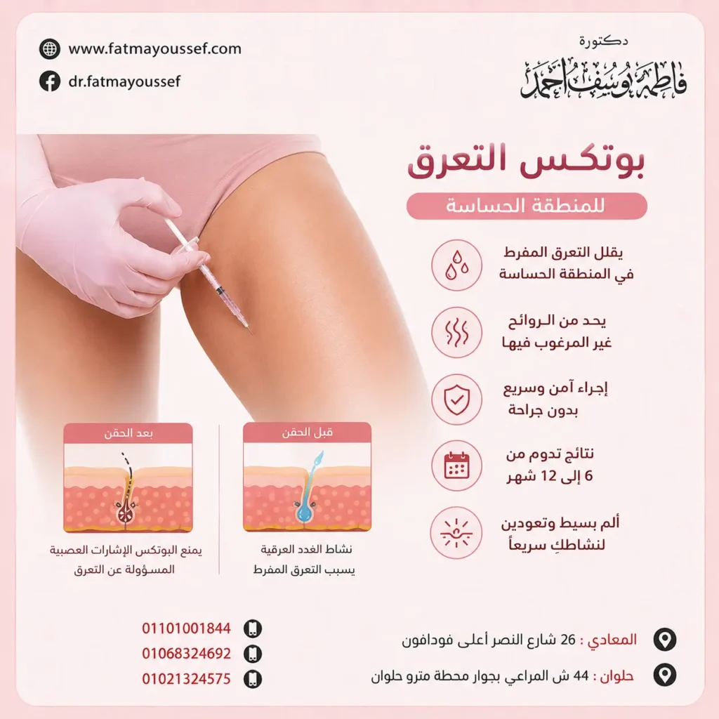 بوتكس التعرق للمنطقه الحساسة