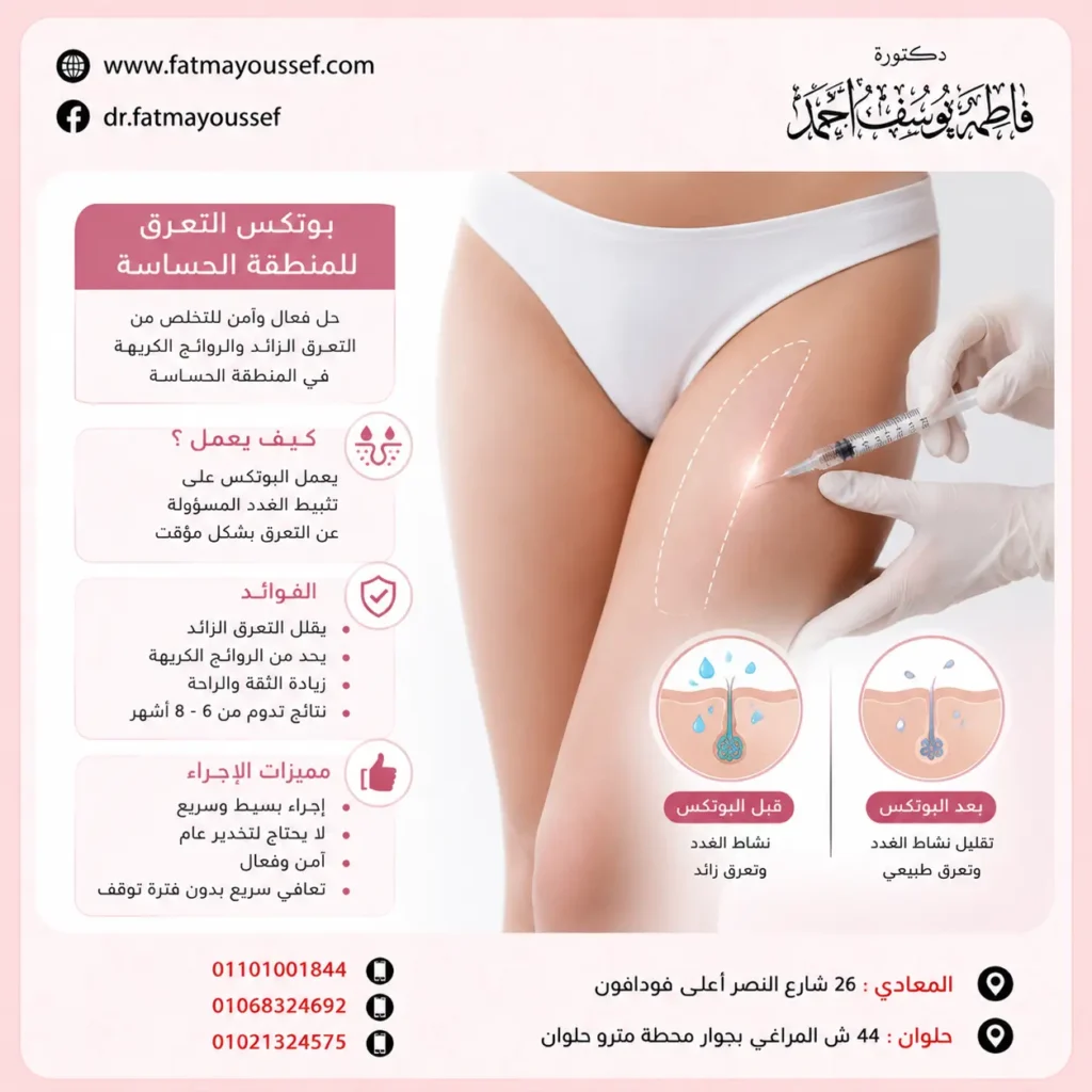 بوتكس التعرق للمنطقه الحساسة
