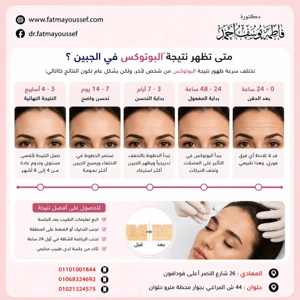 متى تظهر نتيجة البوتوكس في الجبين