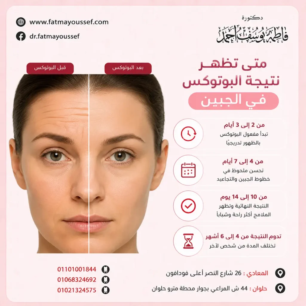 متى تظهر نتيجة البوتوكس في الجبين
