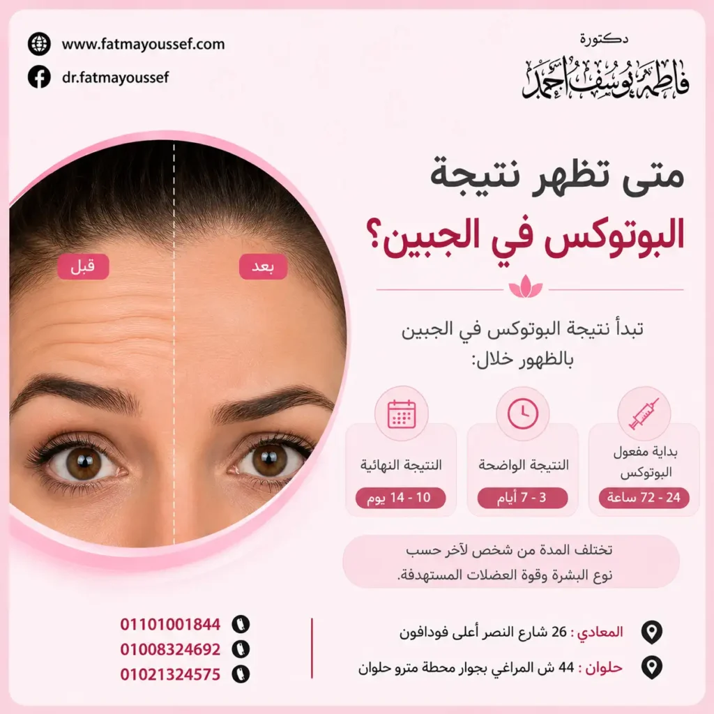 متى تظهر نتيجة البوتوكس في الجبين