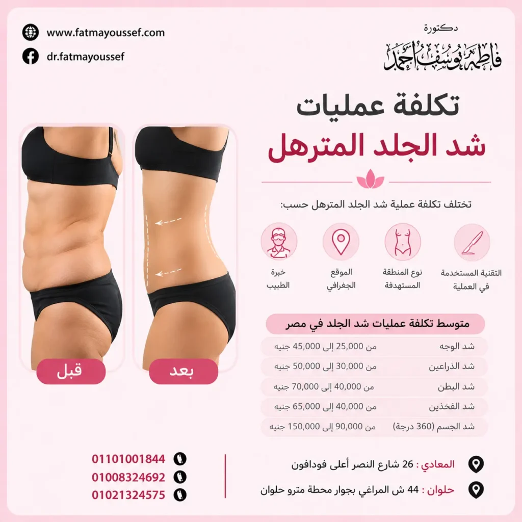 تكلفة عمليات شد الجلد المترهل