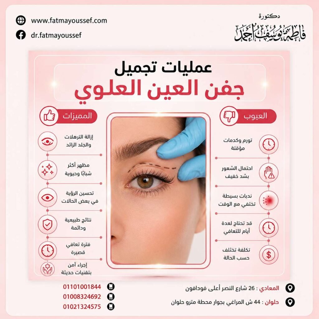 عمليات تجميل جفن العين العلوي