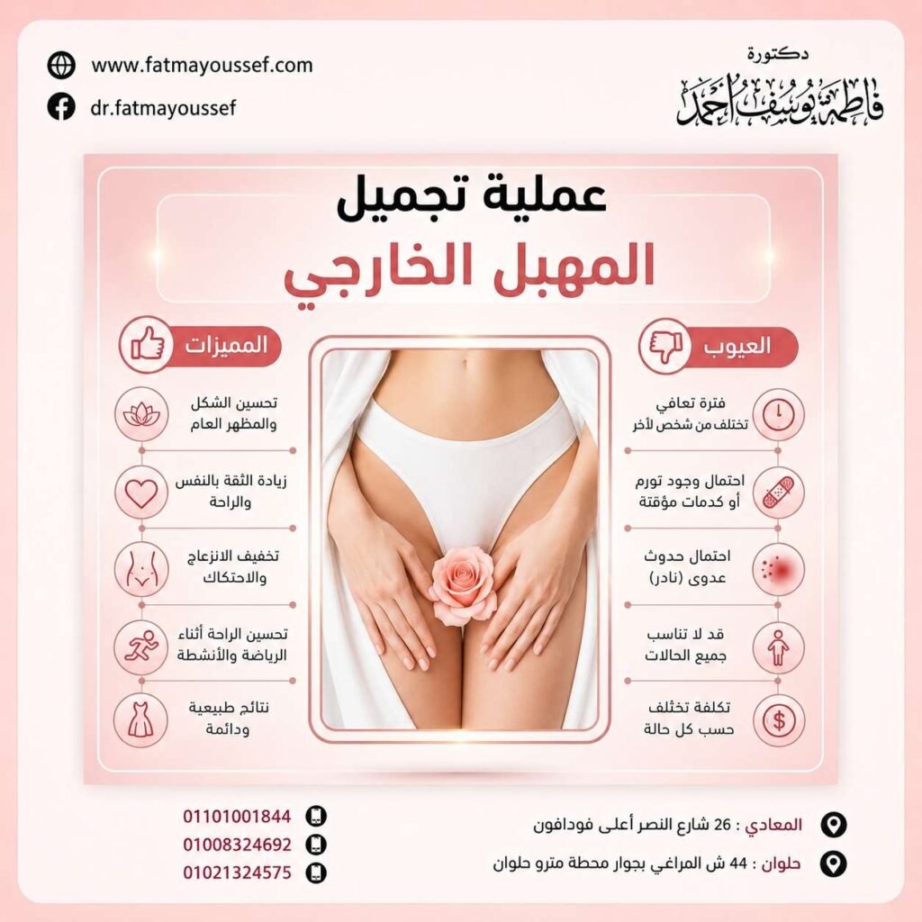 عملية تجميل المهبل الخارجي
