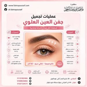عمليات تجميل جفن العين العلوي