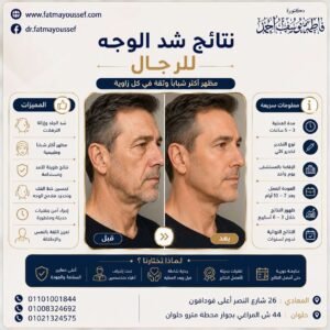 شد الوجه للرجال قبل وبعد