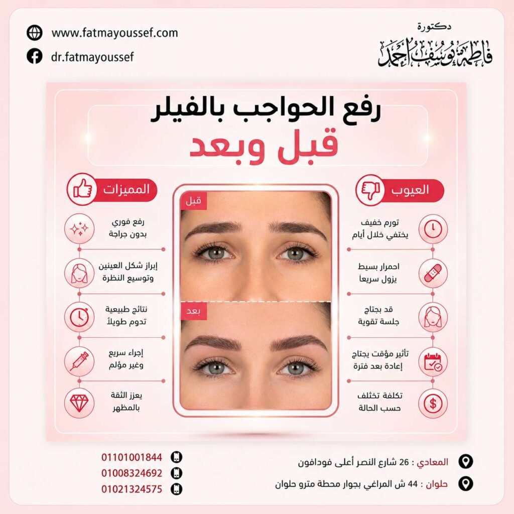 رفع الحواجب بالفيلر قبل وبعد