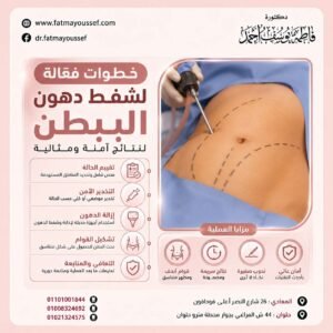 كيفية شفط دهون البطن
