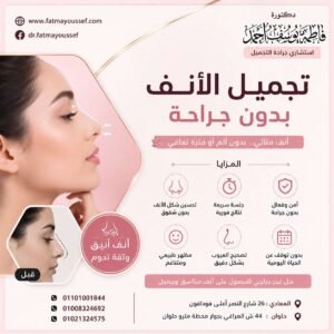 نحت عظمة الأنف بدون جراحة