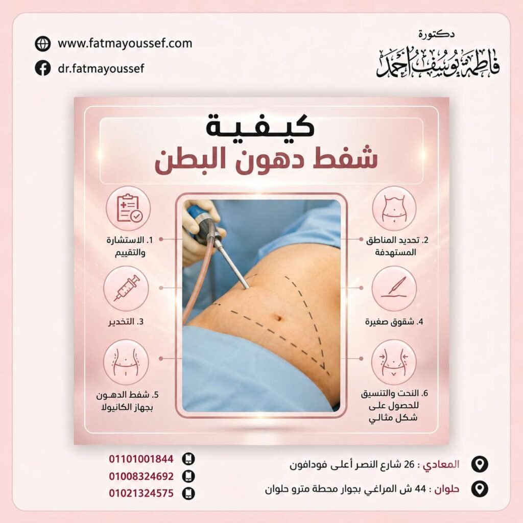 كيفية شفط دهون البطن