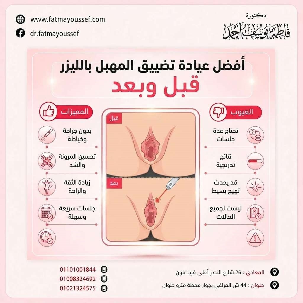 افضل عيادة تضييق المهبل بالليزر